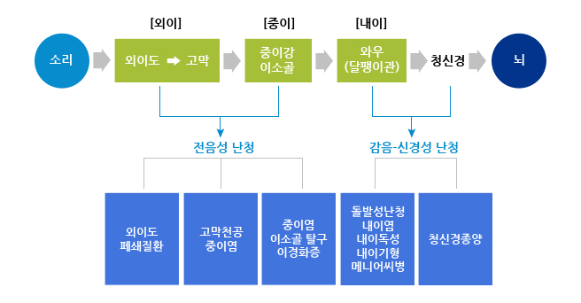 청력의 정도에 따라서 분류 경로