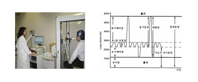 총폐용적+잔기량 검사-TLC+RV(Total Lung Capacity, Residual Volume) 