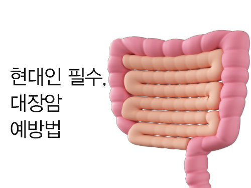 현대인 필수, 대장암 예방법