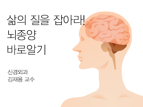 삶의 질을 잡아라! 뇌종양 바로알기