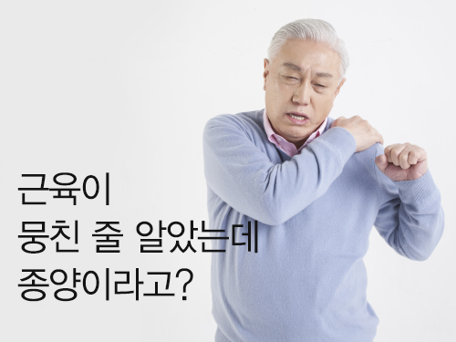 근육이 뭉친 줄 알았는데 종양이라고?