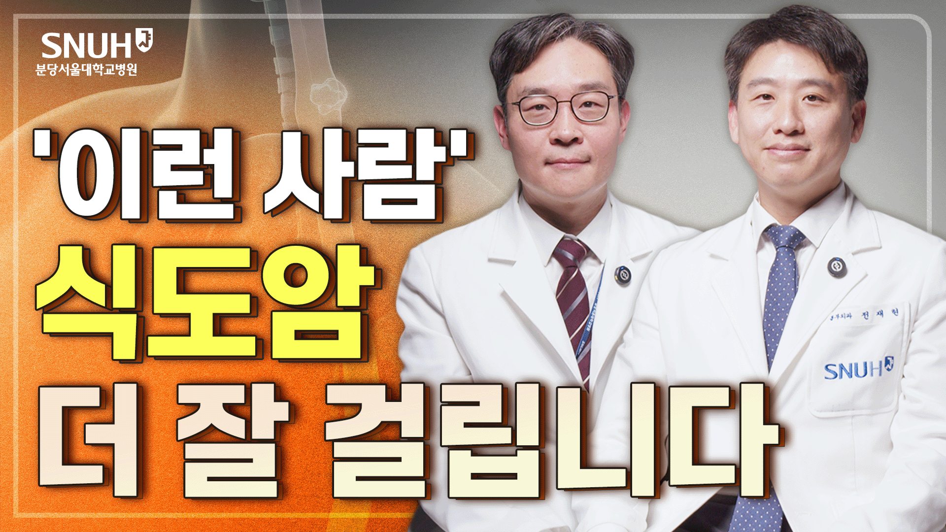 식도암을 막기 위해 꼭 알아야 할 위험 신호