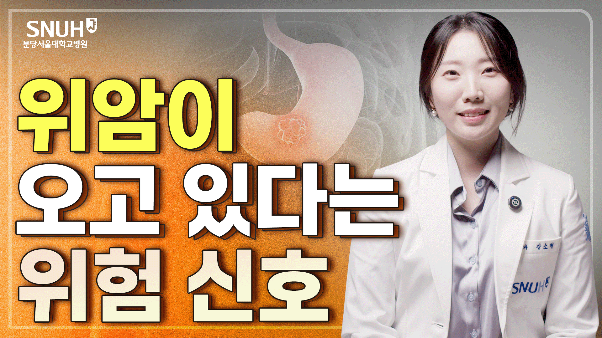 위암 생기기 전 관리해야 하는 위험 신호 및 위암 치료법 [위험신호]