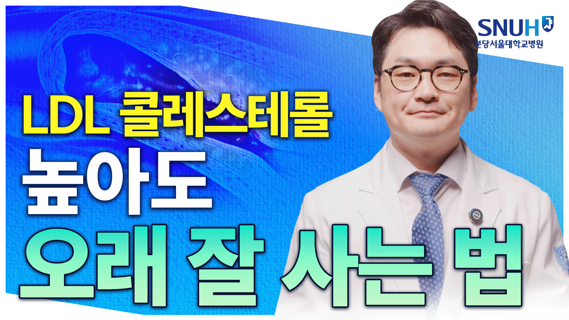 고지혈증 있어도 오래 잘 살 수 있는 특급 비법 [유병장수]
