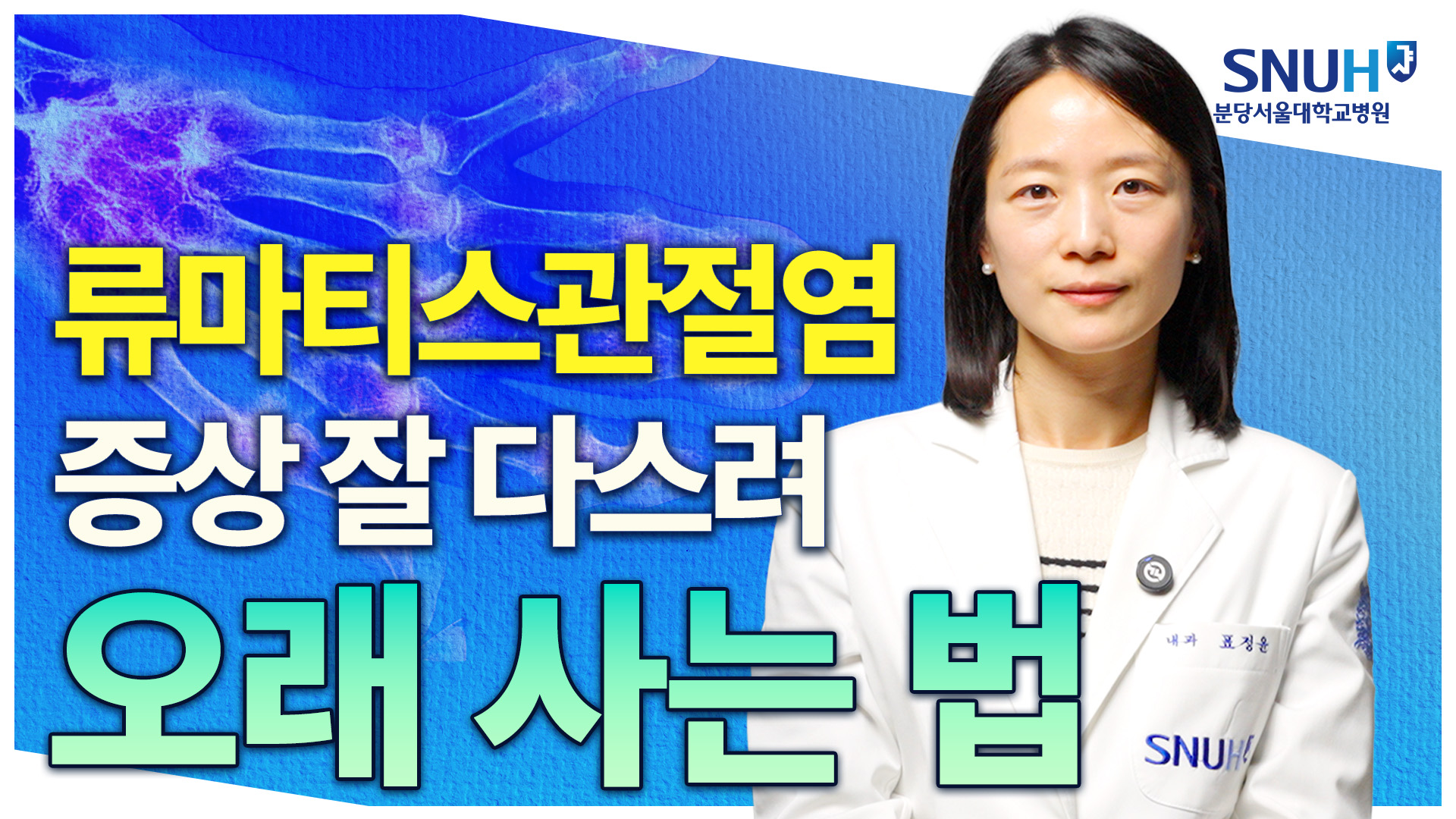 류마티스관절염 있어도 너무 걱정하지 마세요 [유병장수]