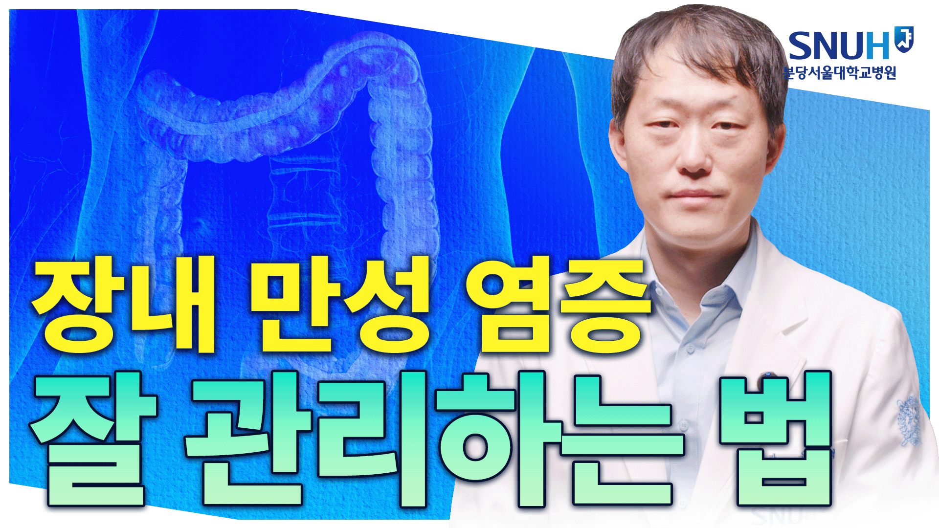 크론병, 궤양성 대장염 있어도 오래 잘 사는 법