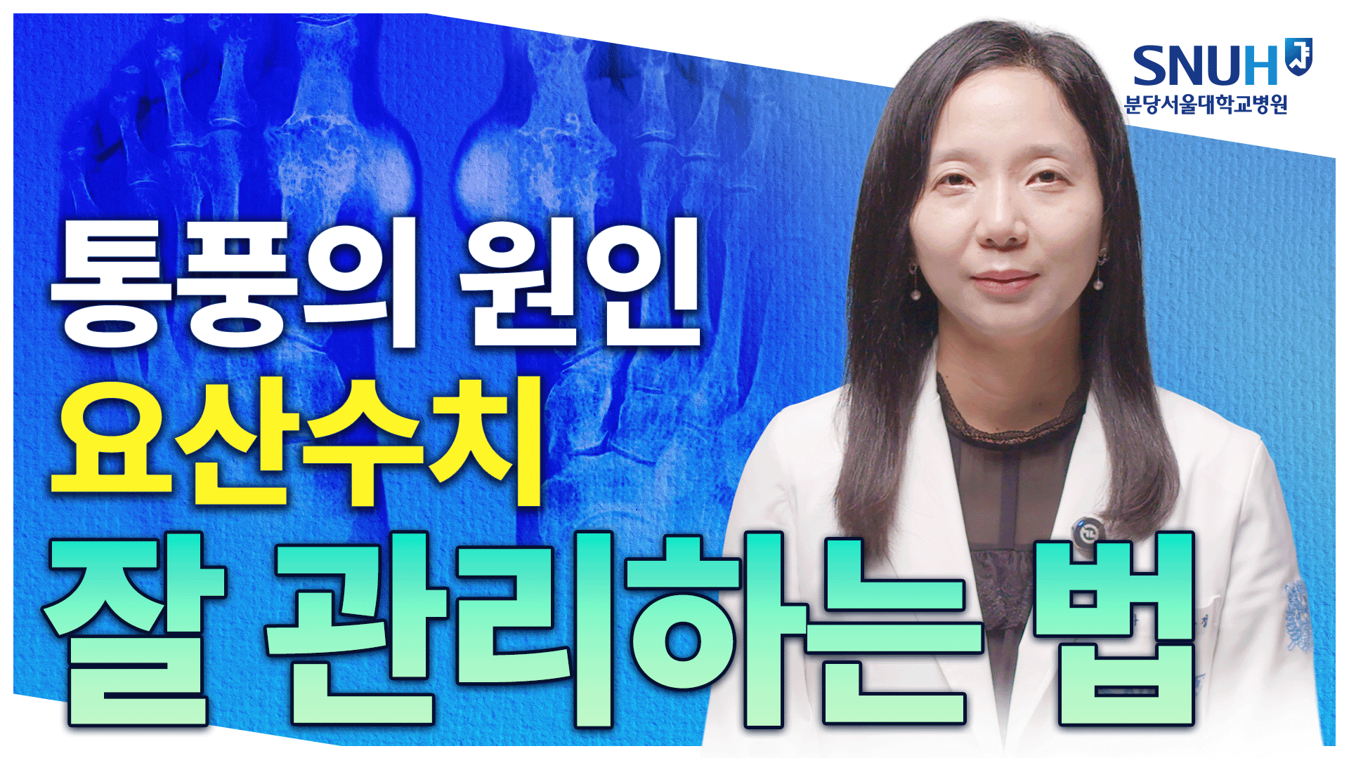 통풍 있어도 잘 살 수 있는 특급 비법 [유병장수]