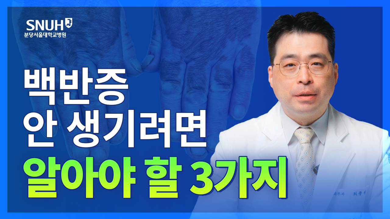 백반증 예방법과 치료법