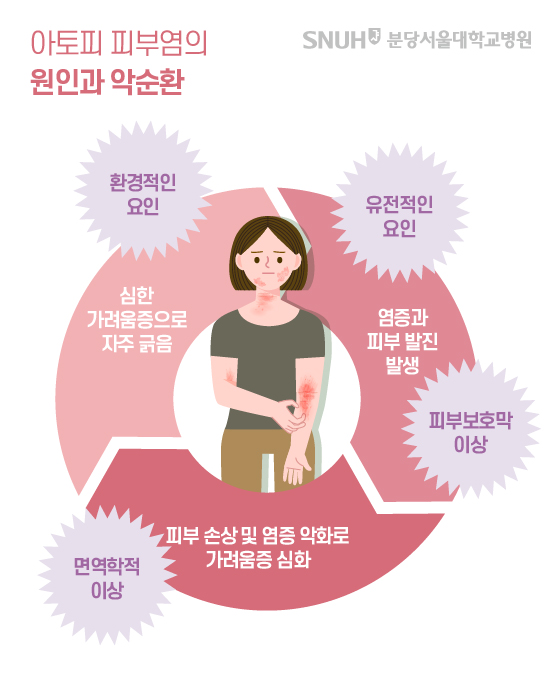 연고를 바른 후에도 계속 재발하는 피부 알레르기의 원인