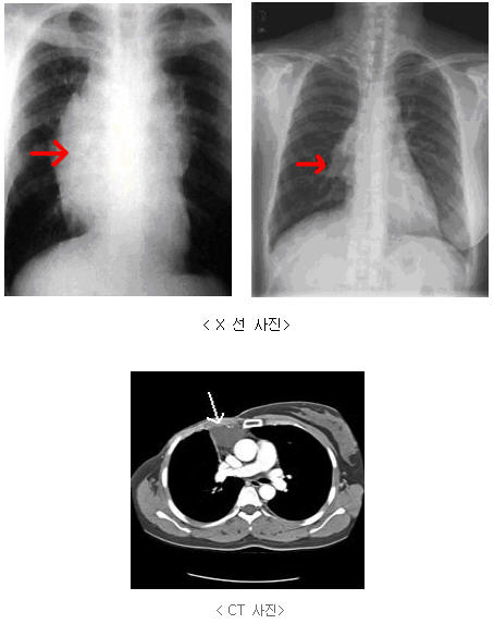 null분당서울대학교병원