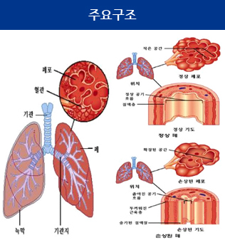 간질성 폐 질환의 종류와 증상, 원인에 대해 알아보도록 합시다.
