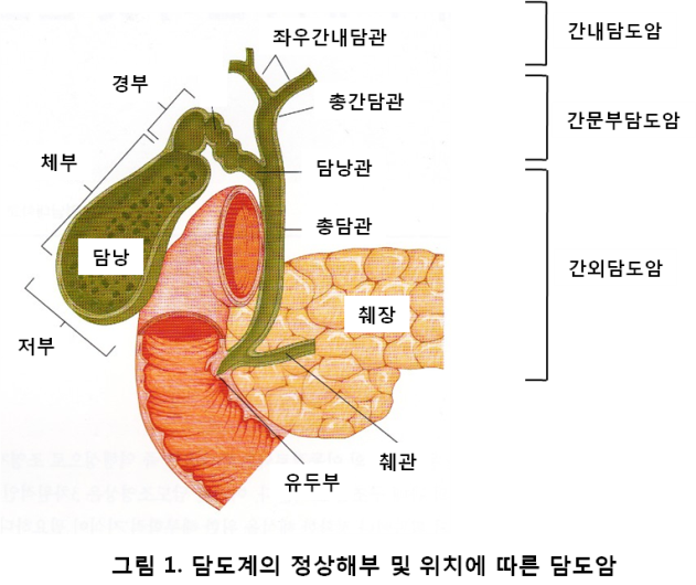 담도암 증상이 나타나면 즉시 치료해야 합니다!