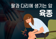 2021.04 팔과 다리에도 암이 생긴다고요? 육종