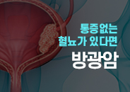 2021.10 통증이 없는 혈뇨가 있다면 의심해보세요, 방광암